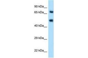 Image no. 1 for anti-Selectin E (SELE) (AA 81-130) antibody (ABIN6746548) (Selectin E/CD62e anticorps  (AA 81-130))