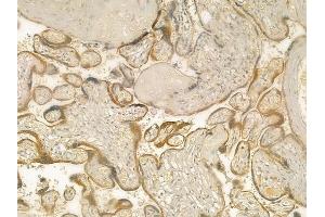 anti-KiSS-1 Metastasis-Suppressor (KISS1) (Internal Region) antibody