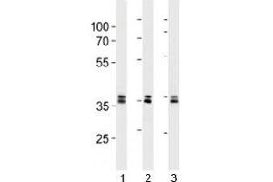 UCH37 antibody western blot analysis in 293, HeLa, 293T lysate. (UCHL5 anticorps)