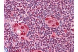 Immunohistochemistry (IHC) image for anti-Cut-Like Homeobox 1 (CUX1) (AA 521-621) antibody (ABIN614596)