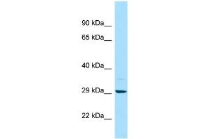 WB Suggested Anti-MAPRE2 Antibody Titration: 1. (MAPRE2 anticorps  (C-Term))