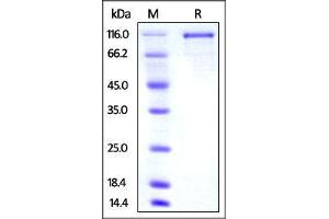 Mouse Transferrin R2, mouse IgG1 Fc Tag on SDS-PAGE under reducing (R) condition. (Transferrin Receptor 2 Protein (TFR2) (AA 103-798) (Fc Tag))