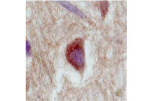 Immunohistochemistry with Brain, cortex tissue at an antibody concentration of 2. (SLC18A1 anticorps  (Middle Region))