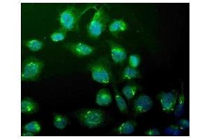 IF analysis of WEE1 using anti-WEE1 antibody (ABIN6719614). (WEE1 anticorps)