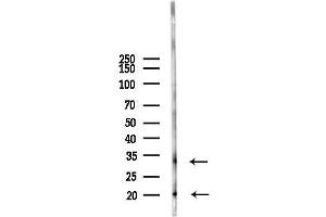 Western blot analysis of lysates from PC12 cells(LPS 4h treatment), using TNFSF15 Antibody at 1/1000 dilution.