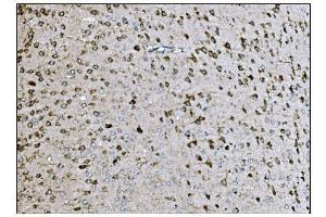IHC analysis of LRP1B using anti-LRP1B antibody (ABIN7601521). (LRP1B anticorps  (AA 3704-4547))