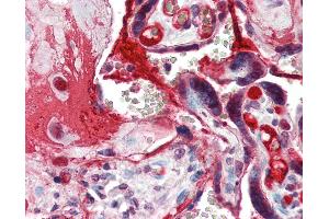 Anti-CCNE1 / Cyclin E1 antibody IHC of human placenta. (Cyclin E1 anticorps  (C-Term))