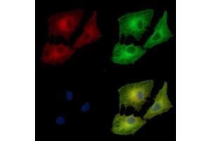 ABIN7095474 and ABIN7099531 staining  cells by IF/ICC.