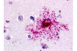 Immunohistochemical staining of Brain (Astrocyte) using anti- GPR84 antibody ABIN122097 (GPR84 anticorps)