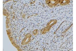 ABIN6276519 at 1/100 staining Human uterus tissue by IHC-P. (CYR61 anticorps  (Internal Region))
