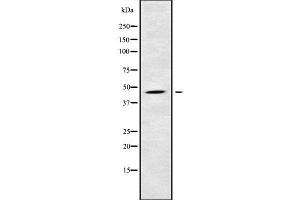 Western blot analysis NKAP using COLO205 whole cell lysates (NKAP anticorps  (N-Term))