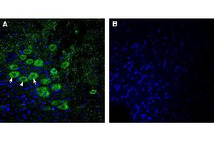 Expression of GPR26 in mouse deep cerebellar nuclei:Immunohistochemical staining of perfusion-fixed frozen mouse brain sections using Anti-GPR26 Antibody (ABIN7581889), (1:300), followed by goat anti-rabbit-AlexaFluor-488.