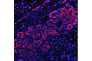 IF analysis of RPL32 using anti-RPL32 antibody (ABIN7602916). (RPL32 anticorps  (C-Term))
