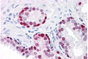 Human Prostate: Formalin-Fixed, Paraffin-Embedded (FFPE)