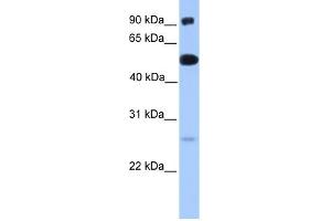 WB Suggested Anti-ETV5 Antibody Titration:  0. (ETV5 anticorps  (N-Term))