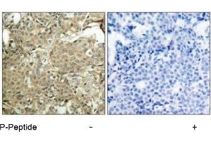 Image no. 1 for anti-Cofilin 1 (CFL1) (pSer3) antibody (ABIN196855) (Cofilin anticorps  (pSer3))