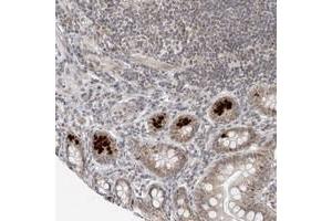 Immunohistochemical staining of human small intestine with TOX4 polyclonal antibody  shows strong cytoplasmic positivity in paneth cells. (TOX4 anticorps)