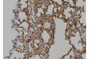 ABIN6263491 and ABIN6268990 at 1/100 staining Mouse lung tissue by IHC-P.