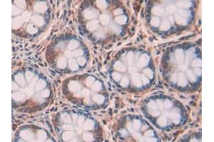 DAB staining on IHC-P; Samples: Human Intestine Tissue