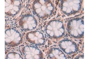 DAB staining on IHC-P; Samples: Human Intestine Tissue (RNASET2 anticorps  (AA 25-256))