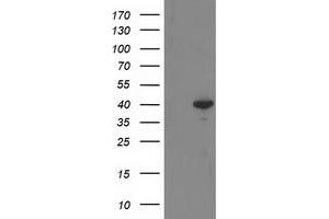 Western Blotting (WB) image for anti-Reticulon 4 Interacting Protein 1 (RTN4IP1) antibody (ABIN1500771) (RTN4IP1 anticorps)
