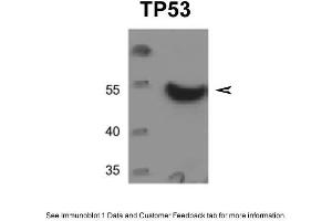 WB Suggested Anti-TP53 Antibody  Titration: 0. (p53 anticorps  (C-Term))