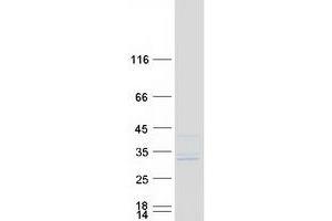 Validation with Western Blot