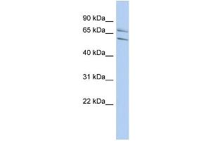 WB Suggested Anti-PHF21A Antibody Titration:  0. (PHF21A anticorps  (N-Term))