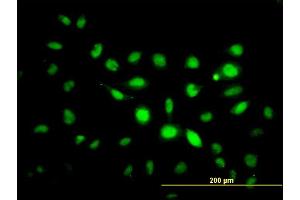 Immunofluorescence of monoclonal antibody to PHF1 on HeLa cell.