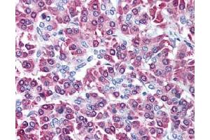 Image no. 3 for anti-Cbl proto-oncogene C (CBLC) (AA 444-458) antibody (ABIN401316) (CBLC anticorps  (AA 444-458))