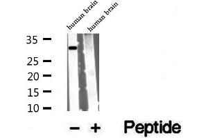 Western blot analysis of extracts of human brain tissue, using VDAC3 antibody.