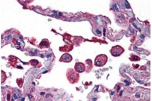 Human Lung: Formalin-Fixed, Paraffin-Embedded (FFPE)