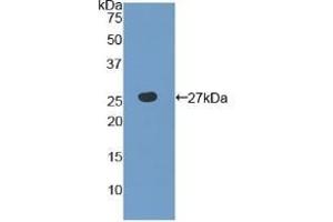 Detection of Recombinant TLR6, Human using Polyclonal Antibody to Toll Like Receptor 6 (TLR6) (TLR6 anticorps  (AA 608-796))