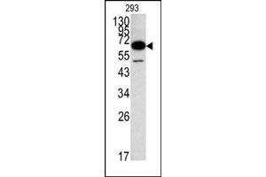 Image no. 1 for anti-Methionyl Aminopeptidase 2 (METAP2) (C-Term) antibody (ABIN357680) (METAP2 anticorps  (C-Term))