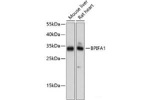 Western blot analysis of extracts of various cell lines using BPIFA1 Polyclonal Antibody at dilution of 1:1000. (BPIFA1 anticorps)