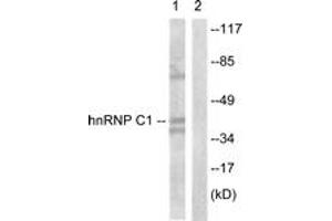 Western blot analysis of extracts from HuvEc cells, treated with EGF 200ng/ml 5', using hnRNP C1/2 (Ab-260) Antibody. (HNRNPC anticorps  (AA 231-280))