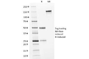 SDS-PAGE Analysis Purified HER-2 Mouse Monoclonal Antibody (HRB2/282). (ErbB2/Her2 anticorps  (Extracellular Domain))