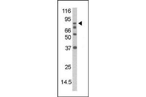 The anti-Phospho-DAXX- Pab  is used in Western blot to detect Phospho-DAXX- in mouse thymus tissue lysate (DAXX anticorps  (pSer213))
