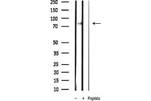 Western blot analysis of Phospho-S (Tyr693) expression in Mouse heart tissue lysate