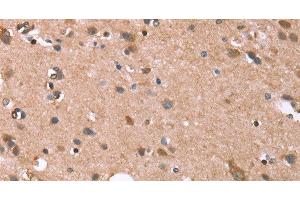 Immunohistochemistry of paraffin-embedded Human brain tissue using GPC6 Polyclonal Antibody at dilution 1:40