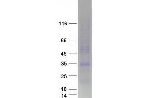 LEPROTL1 Protein (Transcript Variant 1) (Myc-DYKDDDDK Tag)