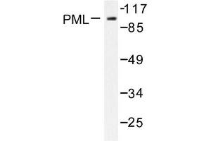 Image no. 1 for anti-Promyelocytic Leukemia (PML) antibody (ABIN271787) (PML anticorps)