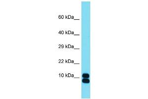 Host: Rabbit  Target Name: Rpl35  Sample Tissue: Mouse Small Intestine lysates  Antibody Dilution: 1. (RPL35 anticorps  (Middle Region))