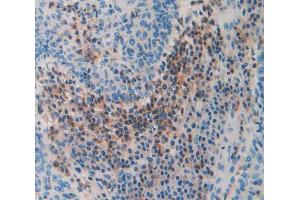 Used in DAB staining on fromalin fixed paraffin- embedded Kidney tissue (THBS3 anticorps  (AA 670-921))