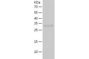 Western Blotting (WB) image for Melanoma Antigen Family A, 4 (MAGEA4) (AA 1-317) protein (His tag) (ABIN7123889)