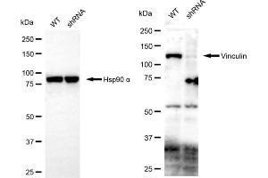 Western blotting analysis using vinculin antibody (ABIN7800841). (Vinculin anticorps)