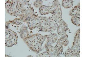 Image no. 1 for anti-Cullin-Associated and Neddylation-Dissociated 1 (CAND1) (AA 1-101) antibody (ABIN599270) (CAND1 anticorps  (AA 1-101))