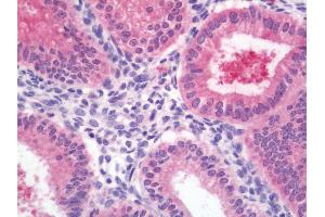 Anti-DNAJC10 antibody IHC staining of human uterus, endometrium.