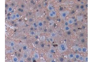 Detection of LCNL1 in Rat Liver Tissue using Polyclonal Antibody to Lipocalin Like Protein 1 (LCNL1) (LCNL1 anticorps)