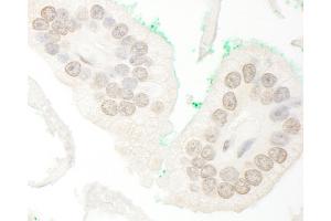Immunohistochemistry (IHC) image for anti-Nuclear Receptor Coactivator 4 (NCOA4) (AA 500-550) antibody (ABIN7448414)